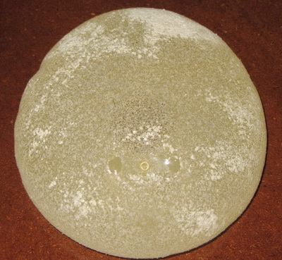 prothèse mammaire anatomique gonflable